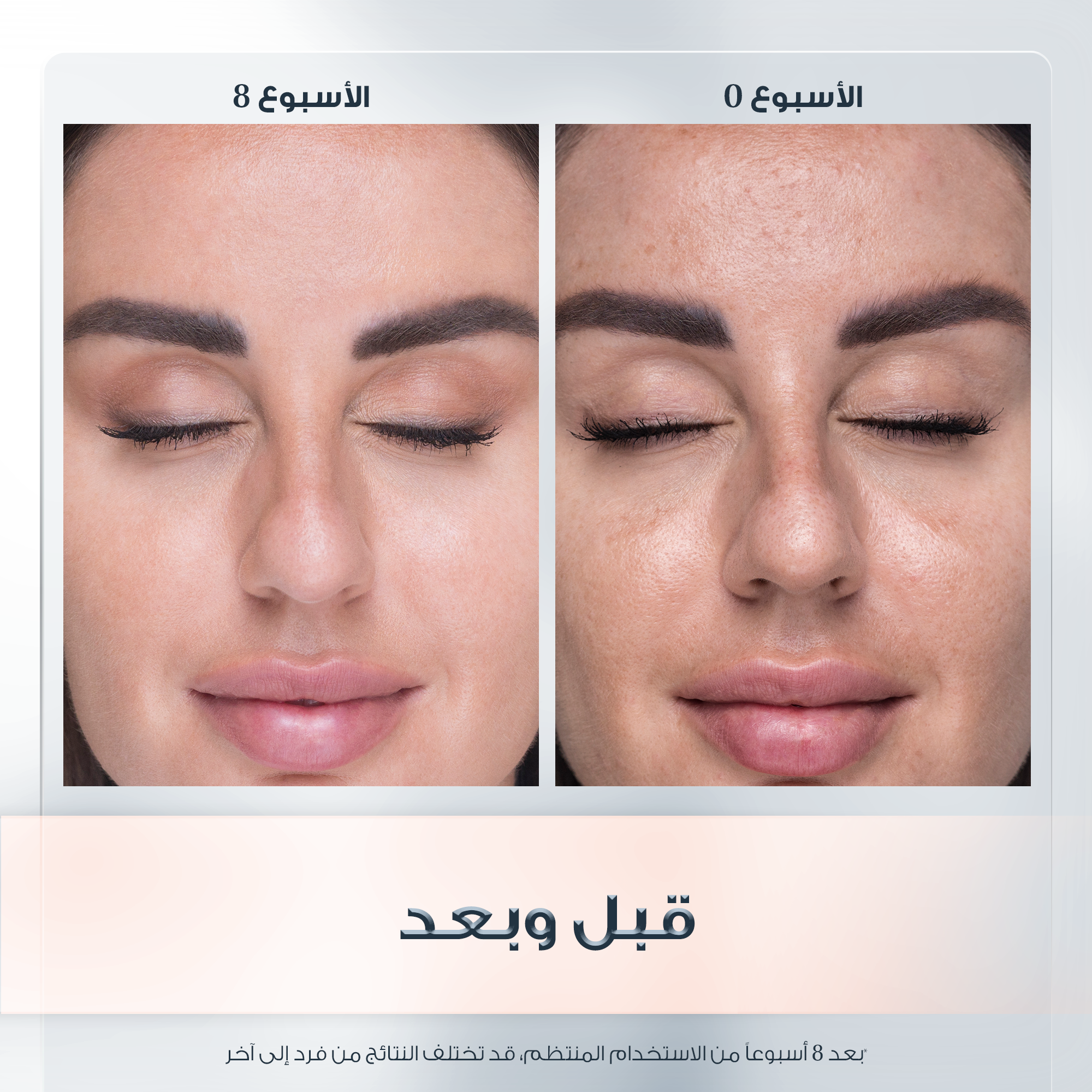 Eucerin Even Pigment Perfector Day 50ml
